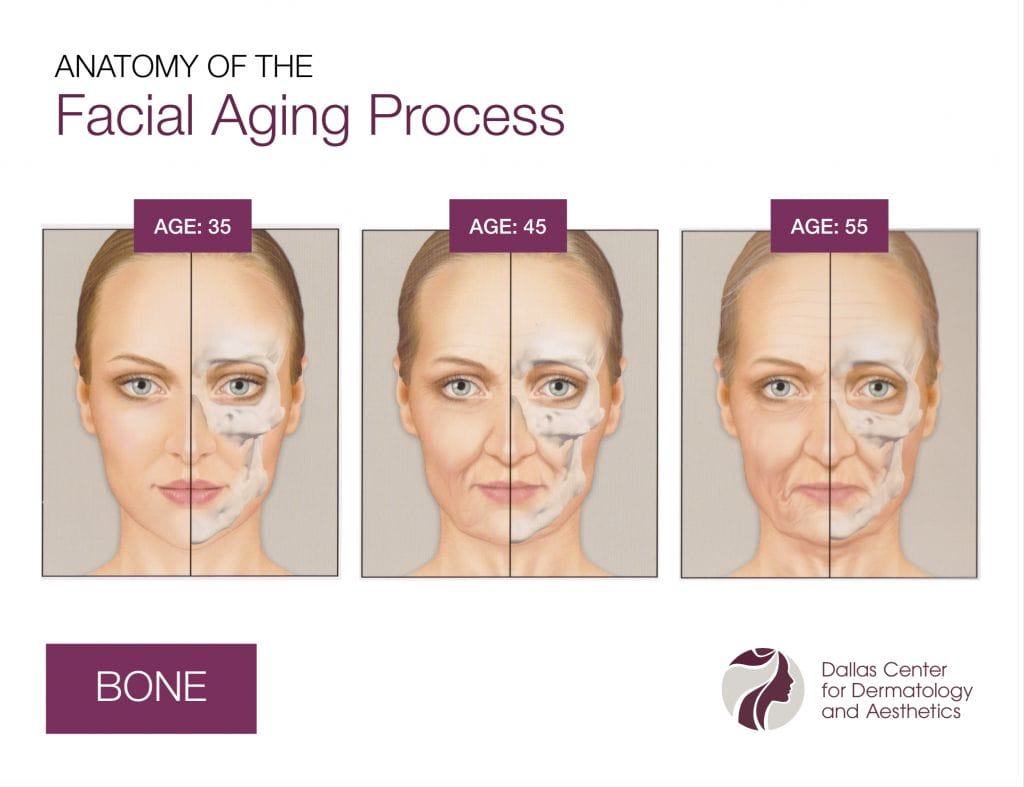 DCDA-Anatomy of the Facial Aging Process_Bone