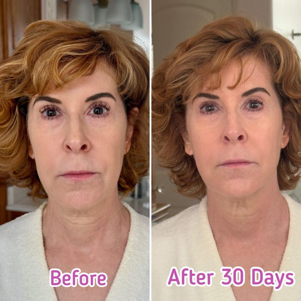 Woman over 50 before and after 30 days using Nira Pro Laser.